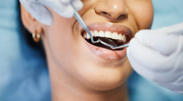 Best Emergency Dentist for Lost Fillings or Crowns in Victoria, MS